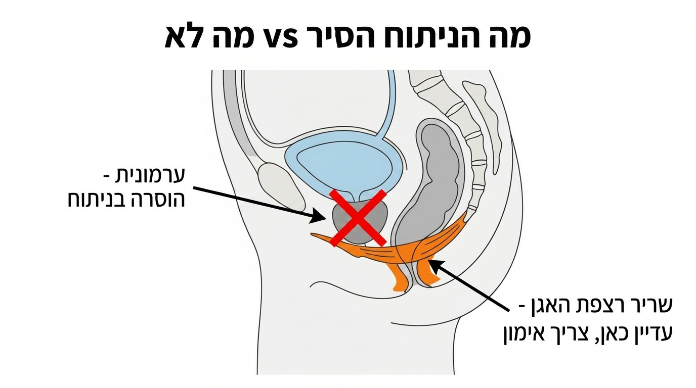 מה הניתוח הסיר vs מה לא - דיאגרמה אנטומית